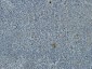 Bcl-2 Monoclonal Antibody(6B5)